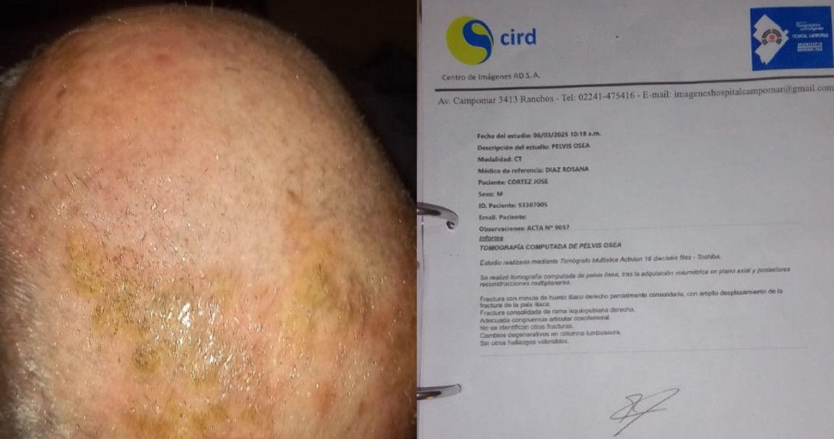 Vecinos cuestionan la calidad del sistema sanitario y reclaman respuestas urgentes a las autoridades.