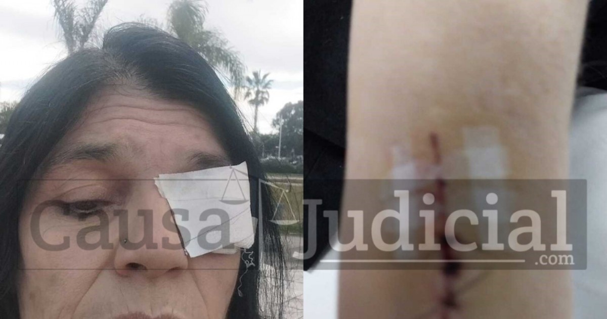 Gabriela Bettiga aseguró haber sido golpeada el domingo por personas que, según ella, actuaron por orden del jefe comunal y candidato a legislador bonaerense.