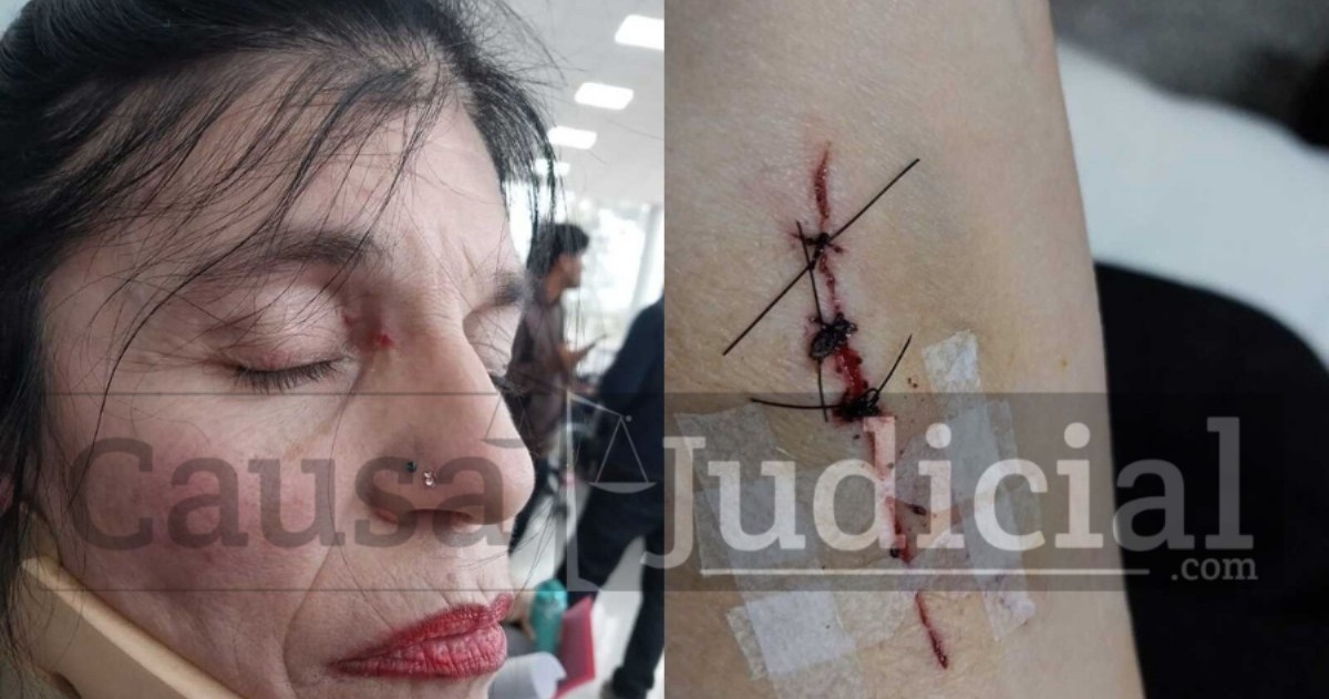 Gabriela Bettiga, militante de La Libertad Avanza, denunció que fue golpeada brutalmente este domingo y responsabilizó al intendente y candidato a legislador Julio Zamora.