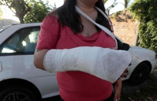 Violencia en La Plata: le fracturaron la muñeca para robarle la bici